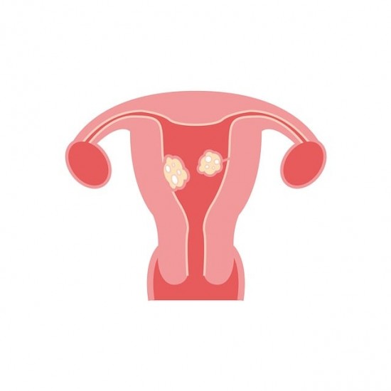 Castor Oil for Fibroids | Castor Oil Guide