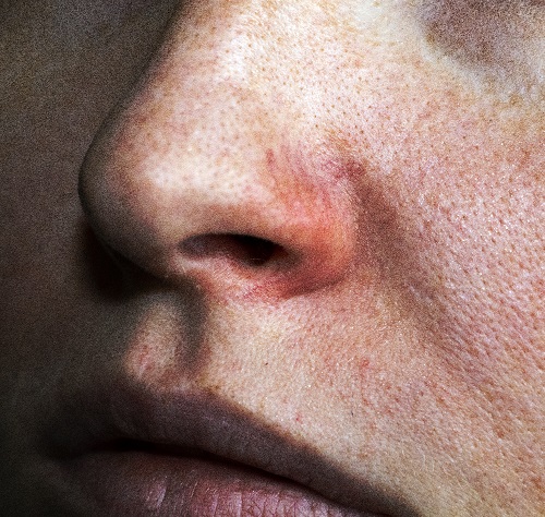 9 Castor Oil Side Effects You Must Know 6