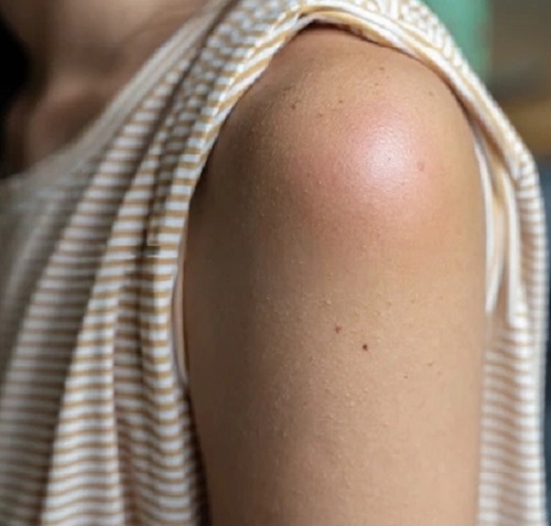 9 Castor Oil Side Effects You Must Know 2