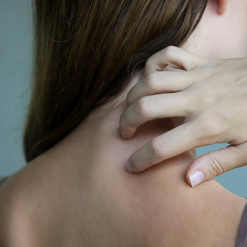 15 Magical Essential Oils for Itching 1
