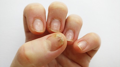 Olive Oil for Nails! 2