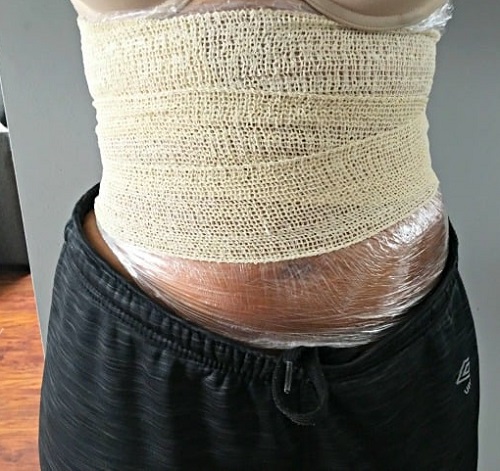 Can Castor Oil Packs Help Endometriosis? 1