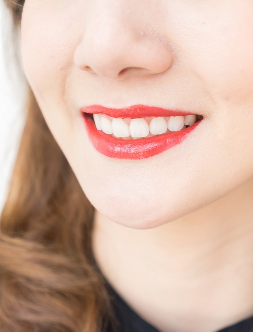 Teeth Whitening