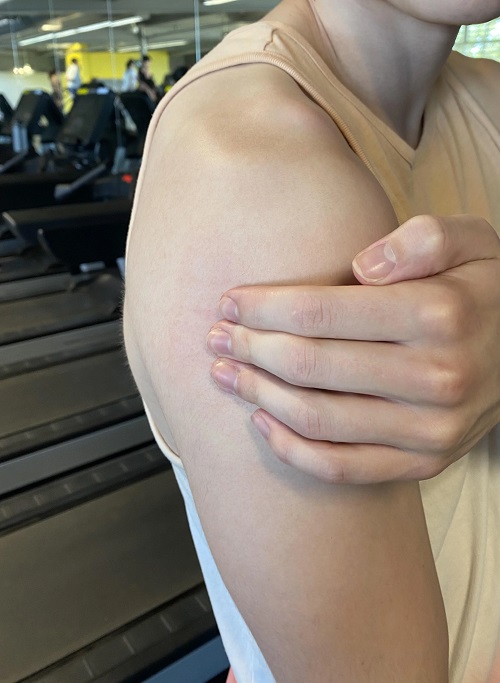 Mild Muscle Soreness