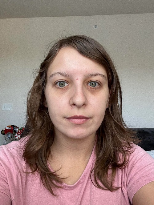 How to Use Coconut Oil For Under Eye Circles 2